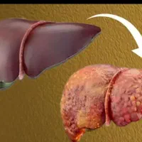 بااین پک هم کبدتو تمیز کن وهم مزاج تو اصلاح کن