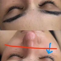 فیشال و پاکسازی پوست و بدن