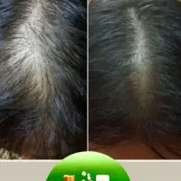 تونیک تقویت کننده مو