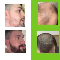 پرشتی رو به خودتون هدیه بدید