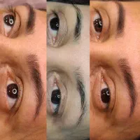 مدل (* رایگان )میکروبلیدینگ ،نانو بلیدینگ و فیبروز