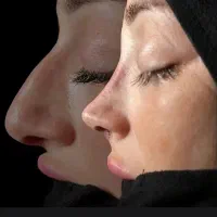 جشنواره تابستانه عمل بینی