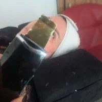 پاکسازی پوست
