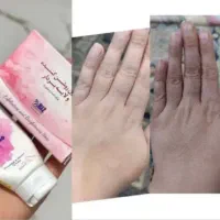 صابون معجزه گر لایه بردار و سفید کننده