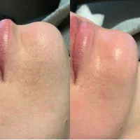 آموزش خدمات فیشیال و پاکسازی پوست