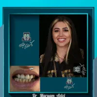 عصب کشی تخصصی دندان در دندانپزشکی باسابقه و مجرب