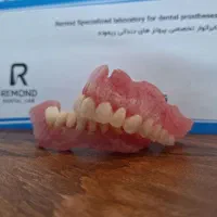 دست دندان مصنوعی خارجی با ضمانت ۱۰ میلیون