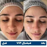 مدل پاکسازی پوست