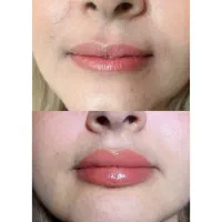 3 نفر فیلر لب .شنبه و یکشنبه .13و14 تیر .690 تومان