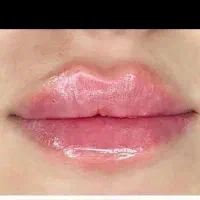 تخفیف ویژه لاین لاغری و زیبایی