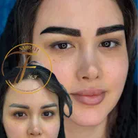 میکروکاشت ابرو طبیعی با ۱۸سال تجربه