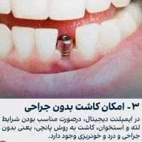 مرکزفوق تخصصی ایمپلنت دیجیتال/بدون درد/روکش فوری