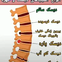 دوره شکسته بندی