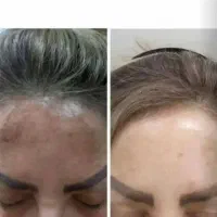 معرفی کرمهای گیاهی|آرایشی، بهداشتی، درمانی|گالیکش, |دیوار