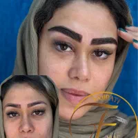 میکروکاشت ابرو طبیعی با ۱۸سال تجربه