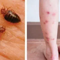 سمپاشی منزل ساس سوسک کل کرج سراسیاب ملارد صفادشت