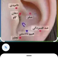 حجامت ،وطب سنتی. درمانگر