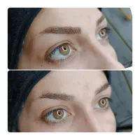 میکروبلیدینگ ابرو
