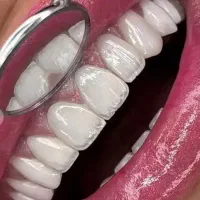 منشی دندانپزشک و کارآموز