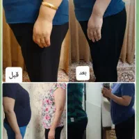 چاقی و لاغری