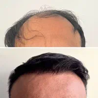 از شیقیه هات شروع میشه