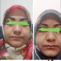 لک قهویی|آرایشی، بهداشتی، درمانی|هشتگرد, مدرس|دیوار