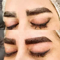 میکرو فیبروز بلید