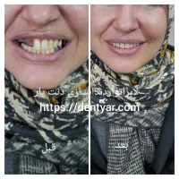 لابراتوار دندانسازی دنت یار