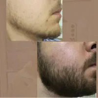 معجزه قرن|خدمات آرایشگری و زیبایی|محمدیه-قزوین, |دیوار