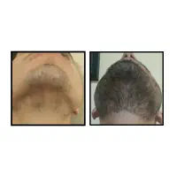برای ریشت یه فرصت دوباره‌ بساز