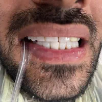 دندانپزشکی و دندان سازی خیریه چمران (جراحی. زیبایی|خدمات آرایشگری و زیبایی|تهران, امام حسین|دیوار