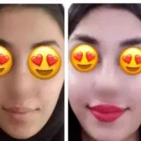 چاقی صورت و کل بدن