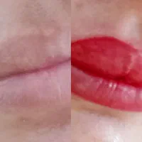 پوست و تتوی دائم ال