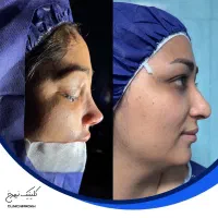 جشنواره بهاره جراحی بینی