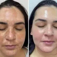 کرم ضد لک لاکچری کوین اصل نمایندگی قم
