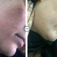 معجزه روغن های طبیعی