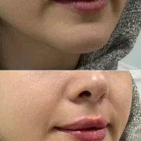 مطب زیبایی ژل بوتاکس لیزر خالبرداری جوانسازی