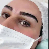 کاشت مو و ابرو در گلپایگان