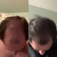 کاشتو بده بره تا وقتی نانوکیت هست
