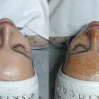 مدل فشیال