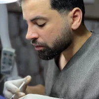 کاشت مو با متد fit