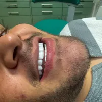 دندانپزشکی ماه دنتال|خدمات آرایشگری و زیبایی|تهران, نارمک جنوبی|دیوار
