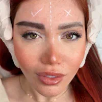 کاشت ابرو زیبایی ابرو لیفت دائم