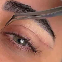 بلفاروپلاستی ساکشن غبغب