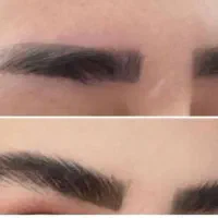 خداحافظی با تتو هاشور حتی کاشت