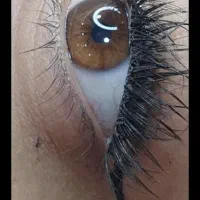 کاشت مژه