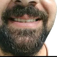 دندان مصنوعی متحرک