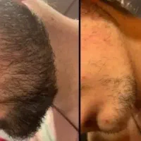 پرونده کم‌پشتی ریشاتو بلند
