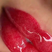 میکروبلیدینگ فیبروز شیدینگ لب از1500