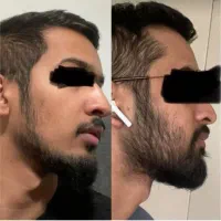 محلول ریش و مو